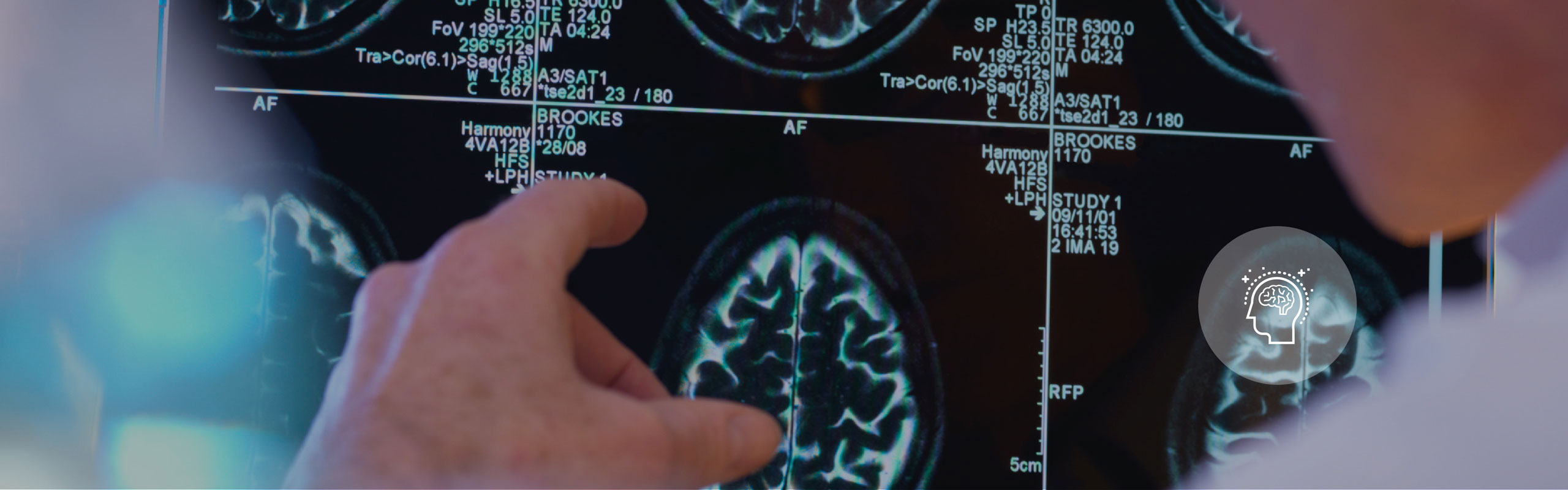 About Us - Neurology: O'Donnell Brain Instititute - Top Banner