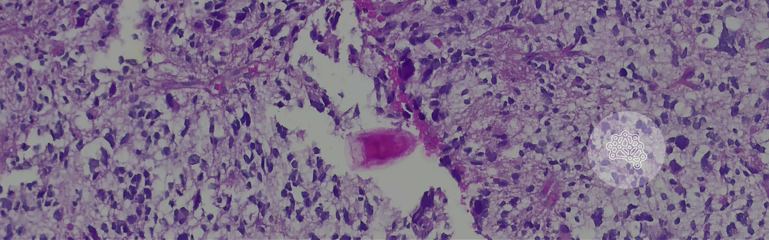 About Us - Neuropathology: O'Donnell Brain Instititute - Top Banner