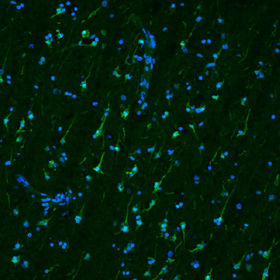 Study of living brain tissue reveals how Parkinson’s treatment works