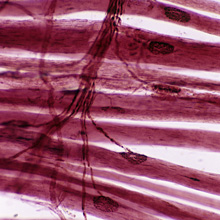 Neuromuscular Disorders