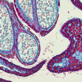 Immunohistochemistry