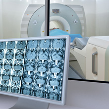Neuro-oncology Imaging